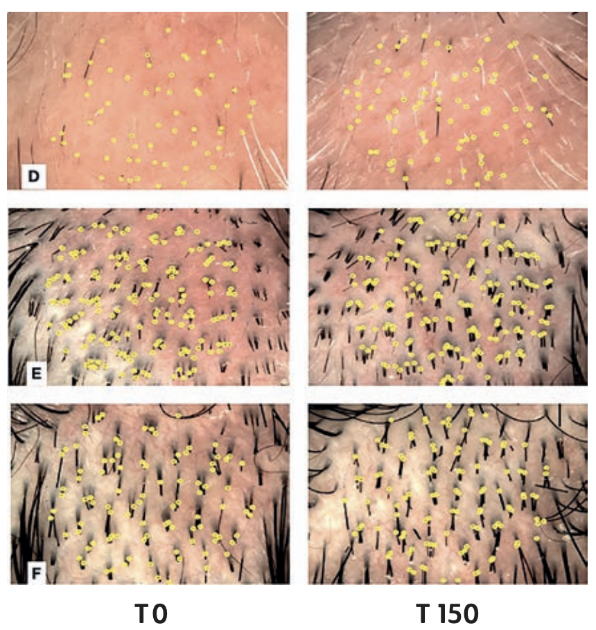 Is There a Way to Try This Without Going All-In?