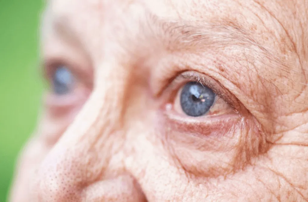 Older adult representing dry age-related macular degeneration