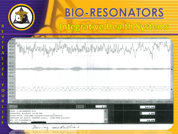 EEG readout during the session showing calmer brain waves