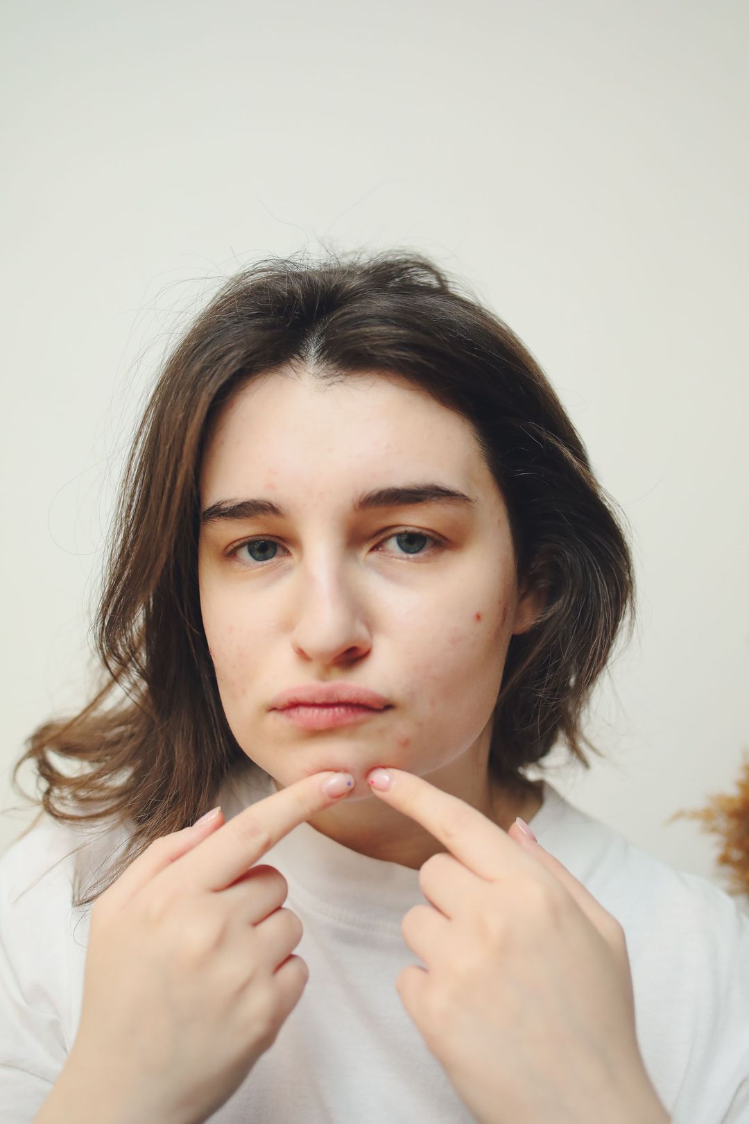 A person with a neutral expression touching their chin and cheek while looking at the camera