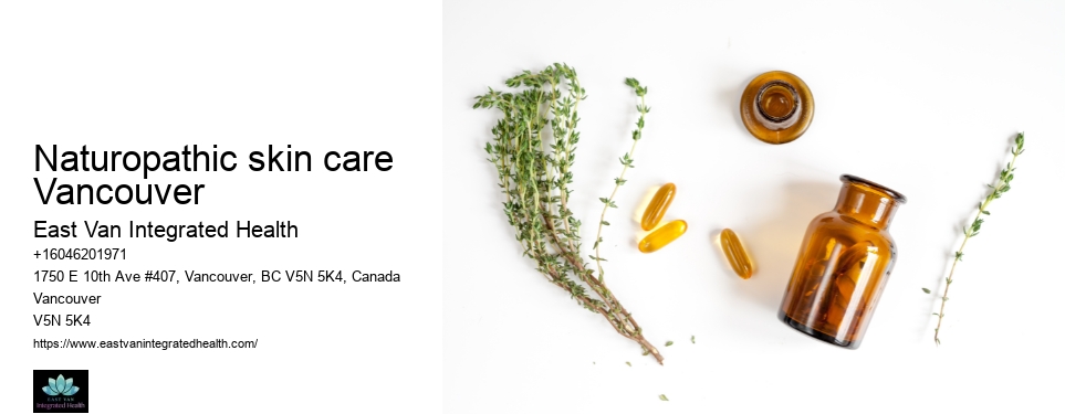 Vancouver Naturopath for Migraines