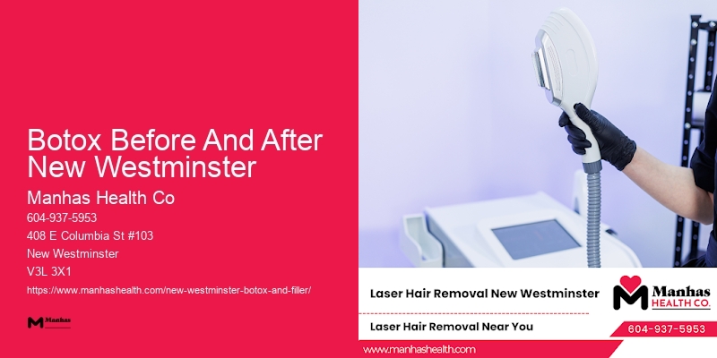 Botox Wrinkle Reduction Botox Before And After New Westminster