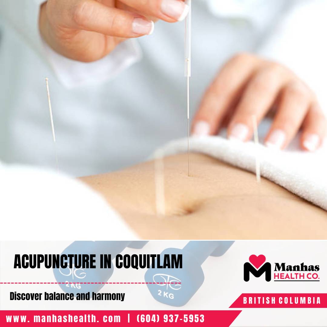 Physiotherapy for sports performance Coquitlam Physiotherapy