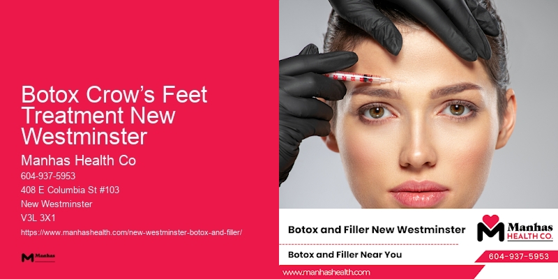 Botox Crow’s Feet Treatment New Westminster