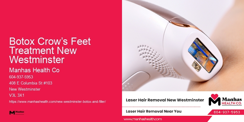 Safe Botox Services Botox Crow’s Feet Treatment New Westminster