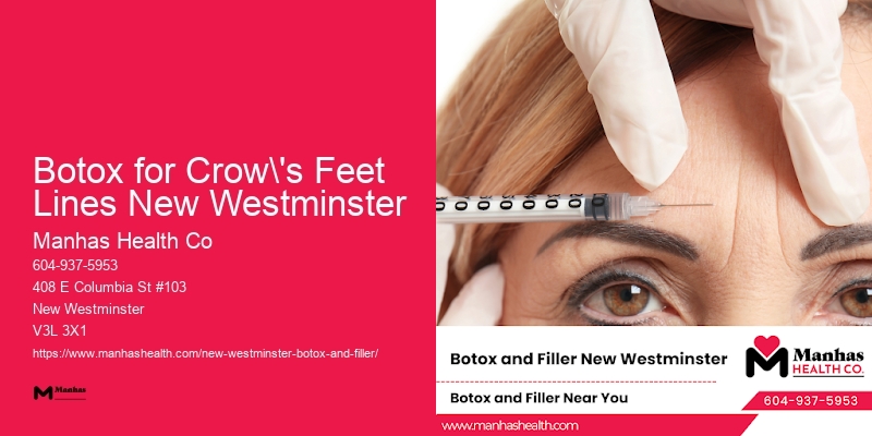 Botox Injection Cost Botox for Crow's Feet Lines New Westminster