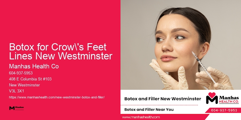 Wrinkle Filler and Botox Botox for Crow's Feet Lines New Westminster