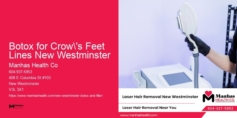 Botox for Crow's Feet Lines New Westminster Botox Specials