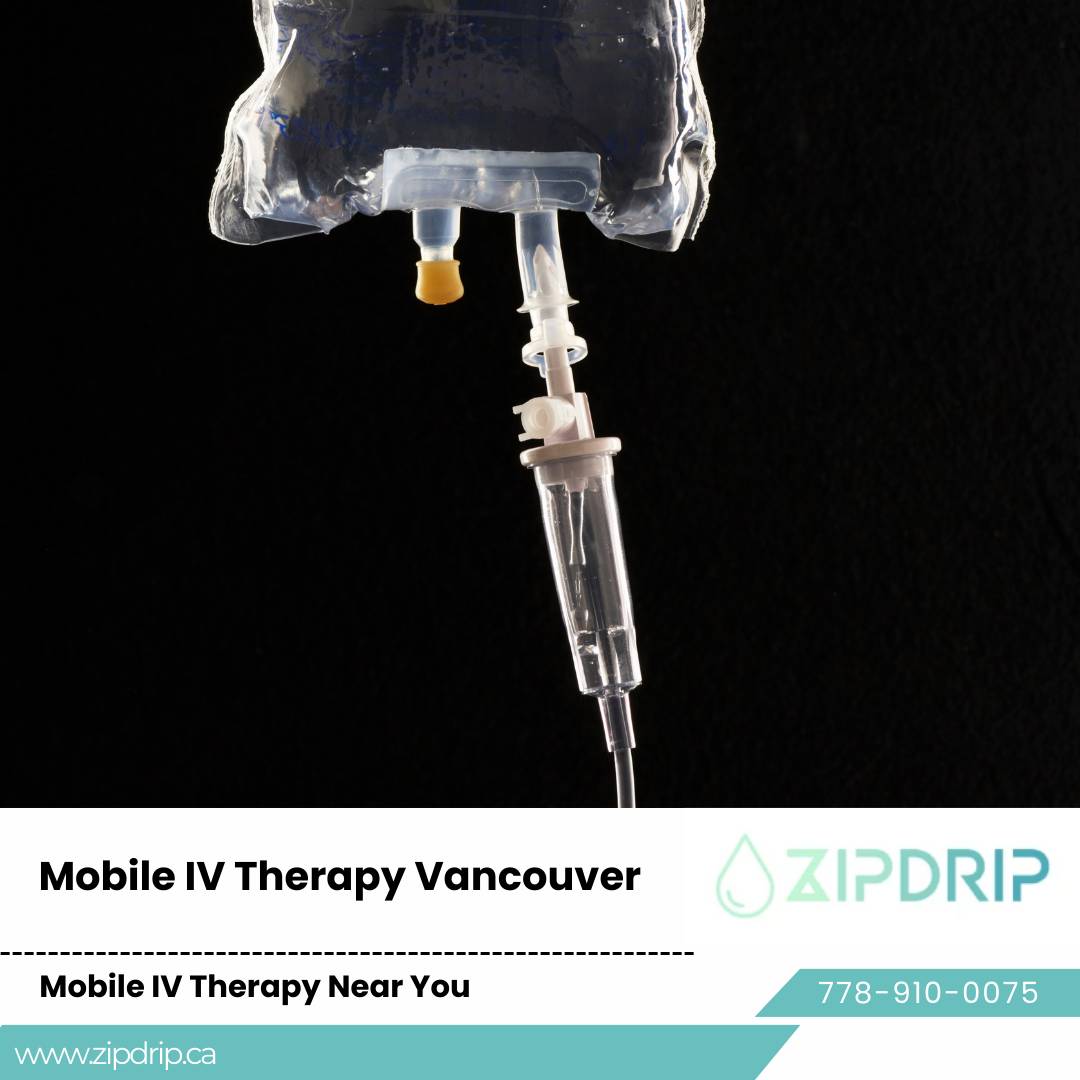 In-Home IV Hydration IV nutrient therapy Vancouver