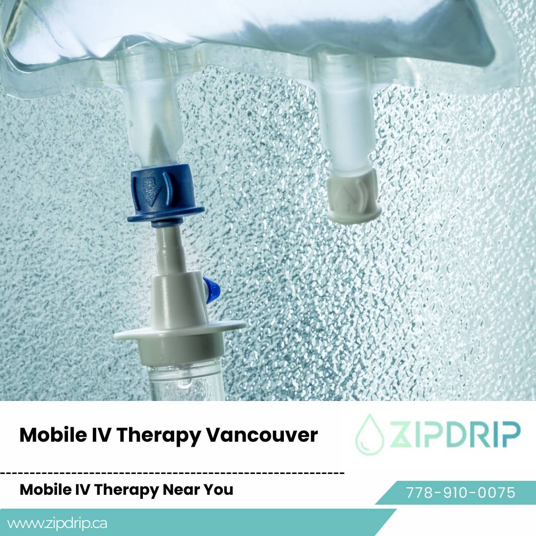 At-Home Hydration Drip Mobile Medical IV Drips Vancouver