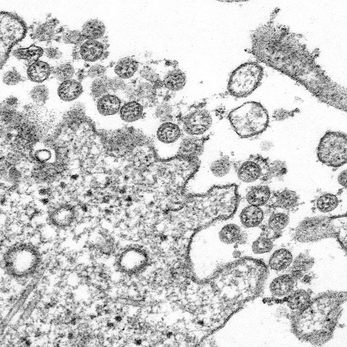 COVID-19 coronavirus image from CDC