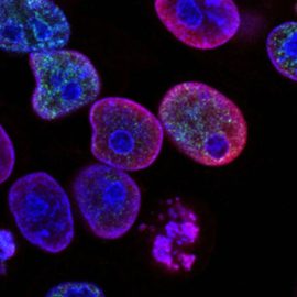 Jason Fung: Shedding Light on the Origins of Cancer