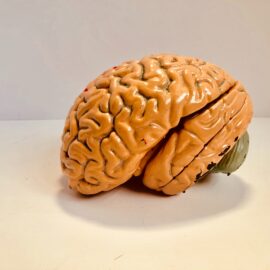 Parkinson’s Disease: Causes & Prevention Measures