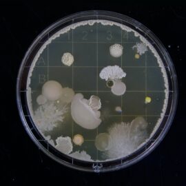 Understanding the Human Gut Microbiome