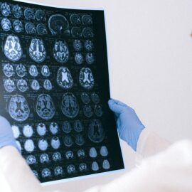 The Indescribable Effects of Psychedelics on the Brain