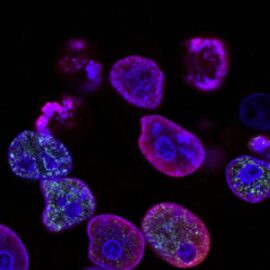 How Do Genes Impact Health and Disease?
