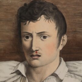 The Yellow Fever Epidemic Begins in Fever 1793