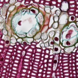 Dave Asprey on Stem Cell Deficiency & Treatments to Stay Young