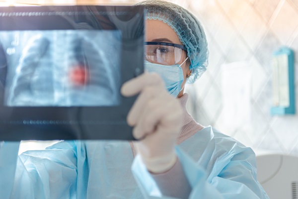 A medical professional in surgical gear examines a chest X-ray displaying a lung abnormality, illustrating the clinical diagnostic process used by medical experts to prove causation in asbestos-related lung cancer cases.