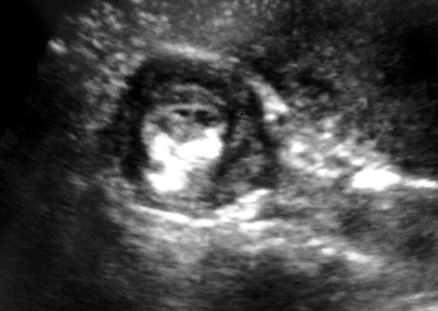 The Hauns in Africa William, Heidi, Trey & KJ's adventures in West Africa