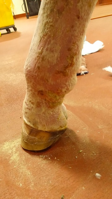 Cellulitis 2 UC Davis