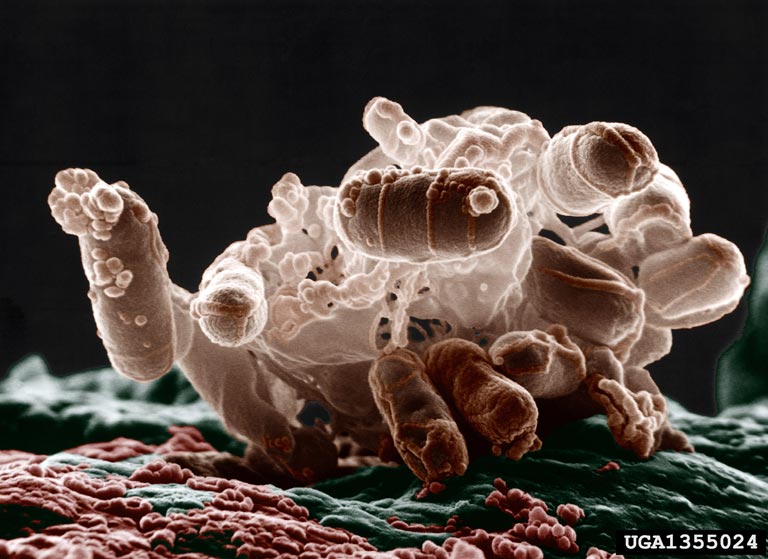 e. Coli