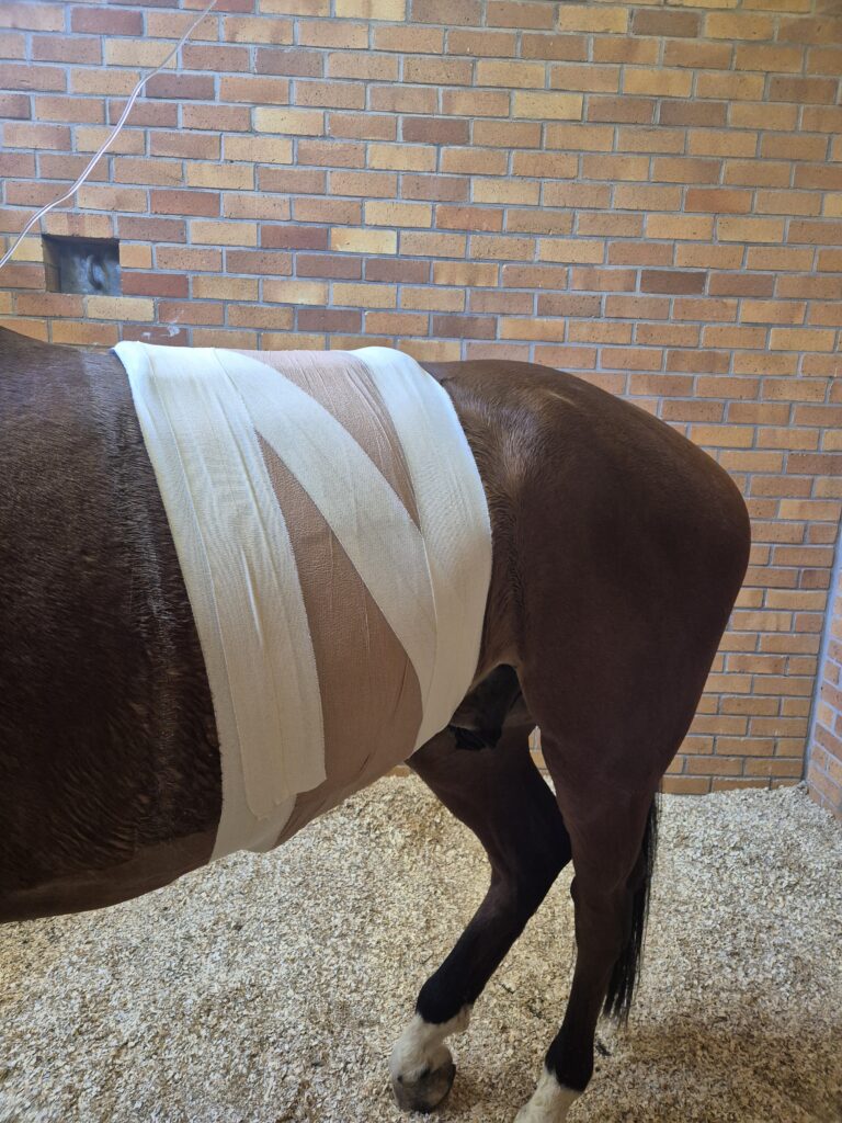 A stent bandage placed over the colic surgery incision for recovery.