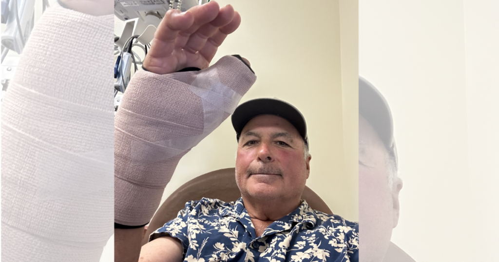 Walt Woodward thumb surgery