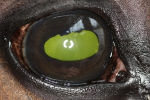 Shedding Light on Posterior Uveitis