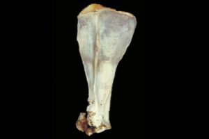 New Surgical Technique for Fixing Equine Shoulder Fractures