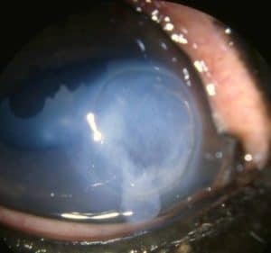 When Corneal Ulcers Get Complicated