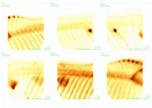 Rib Fractures and Performance Horse Discomfort