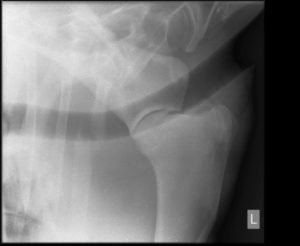 Rib Fractures: A Surprising Cause of Horse Lameness