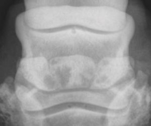Scientists Study Segmented Navicular Bones