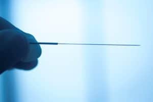 Does Acupuncture Alleviate Navicular Syndrome Pain?