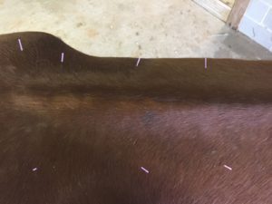 How Does Acupuncture Work?