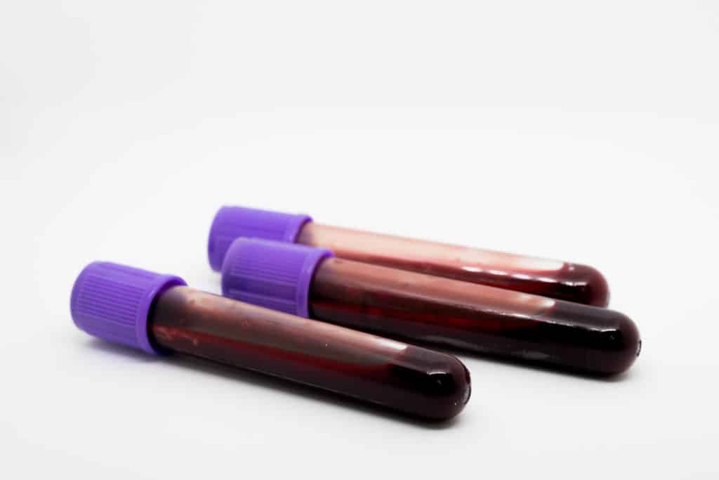 tubes of blood
