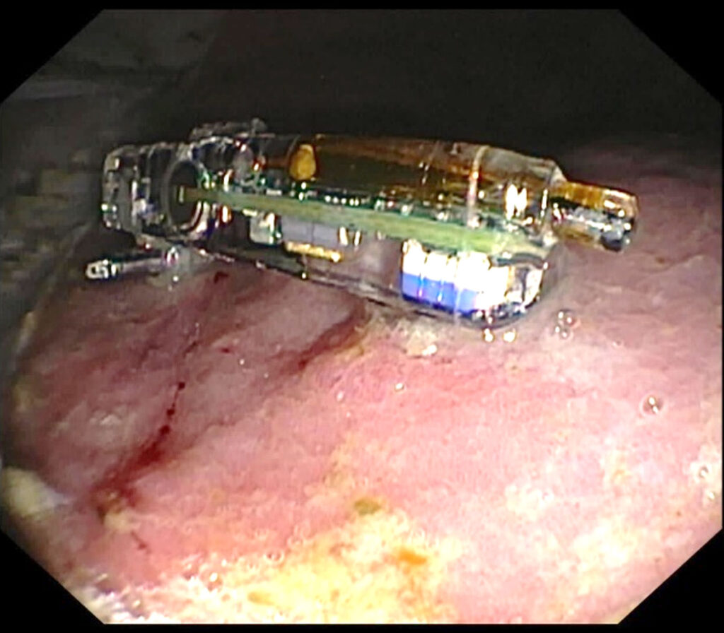 The capsule in the glandular region of the stomach.