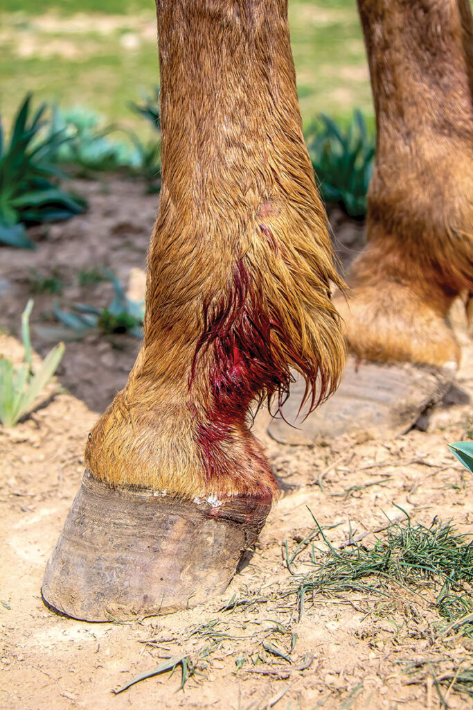 lower leg injury