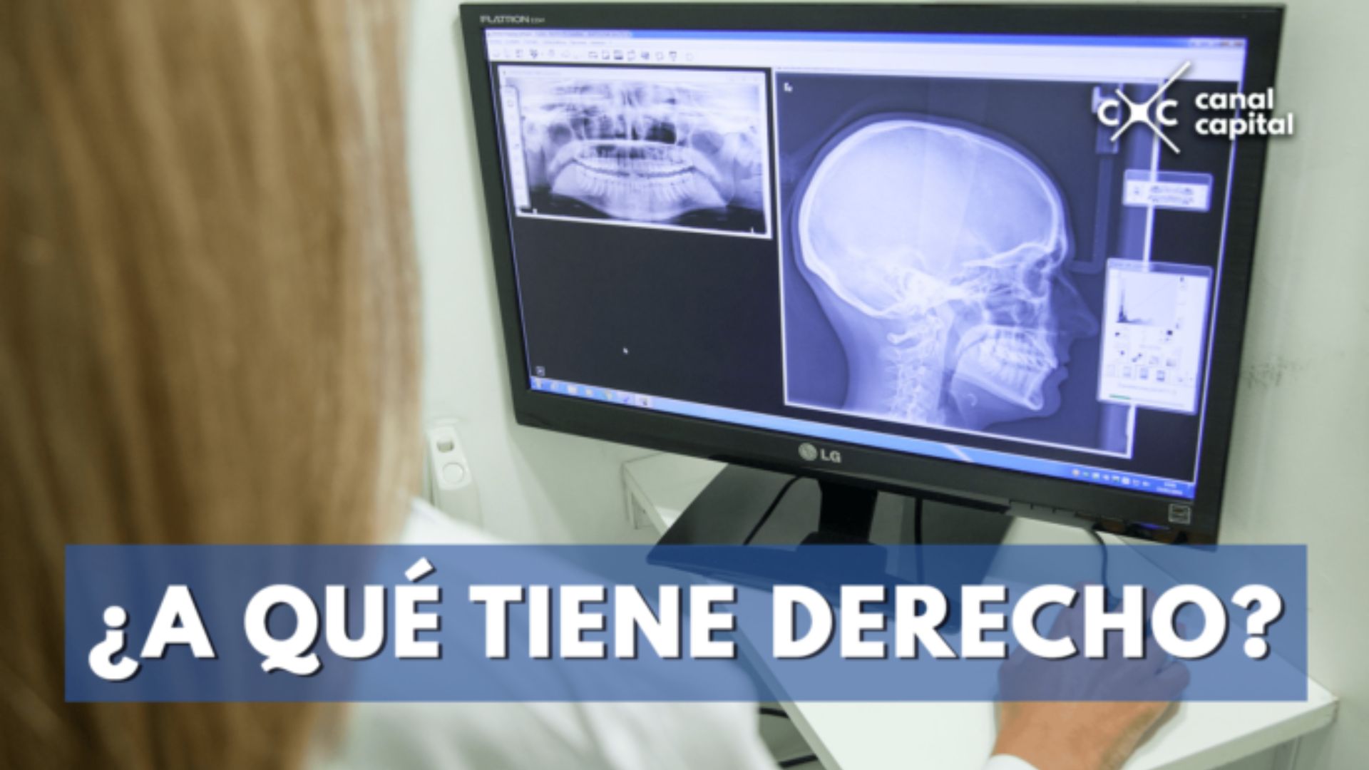 ¿Conoce los servicios odontológicos a los que tiene derecho?