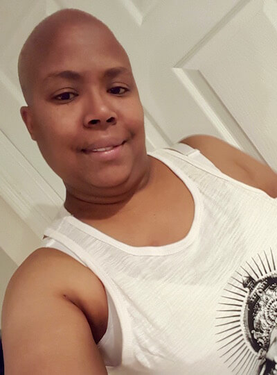 Bisa, after chemotherapy.