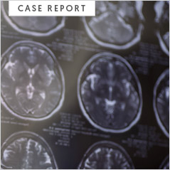 sk-case-report-1