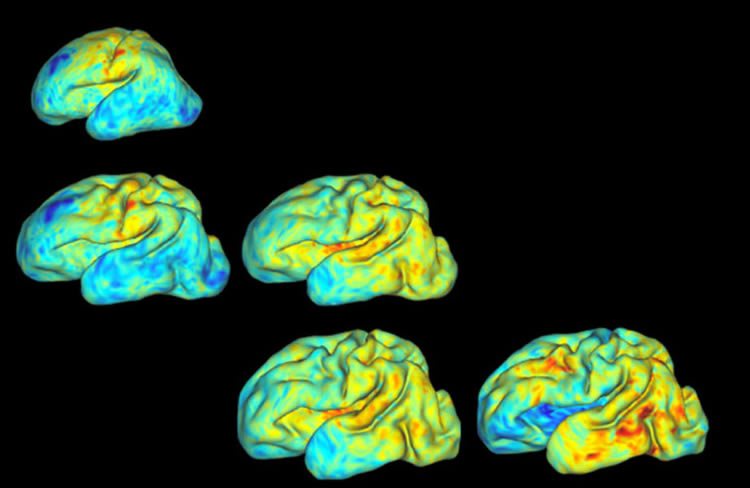 mapping-baby-brains