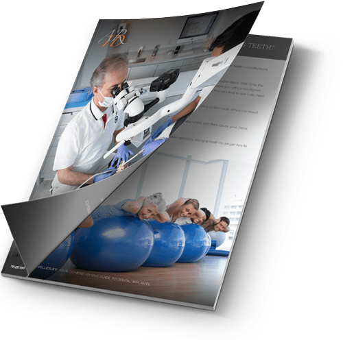 ARID dental implants guide