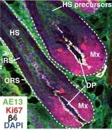 dermal papillae cells DP are favored by most hair cloning researchers for inducing precursor cells to produce new hair