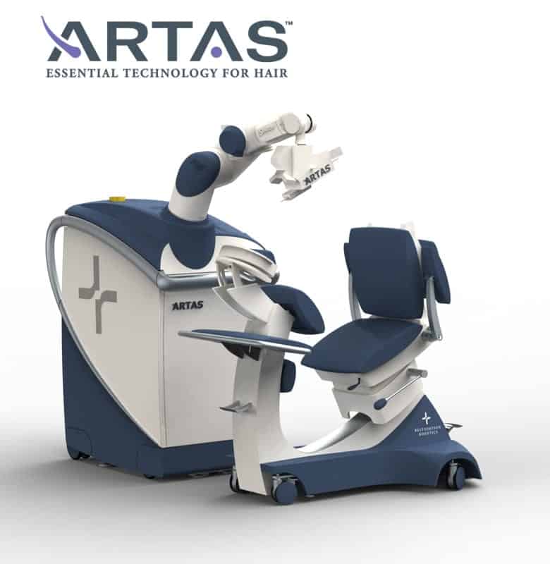 ARTAS automated FUE hair transplant method