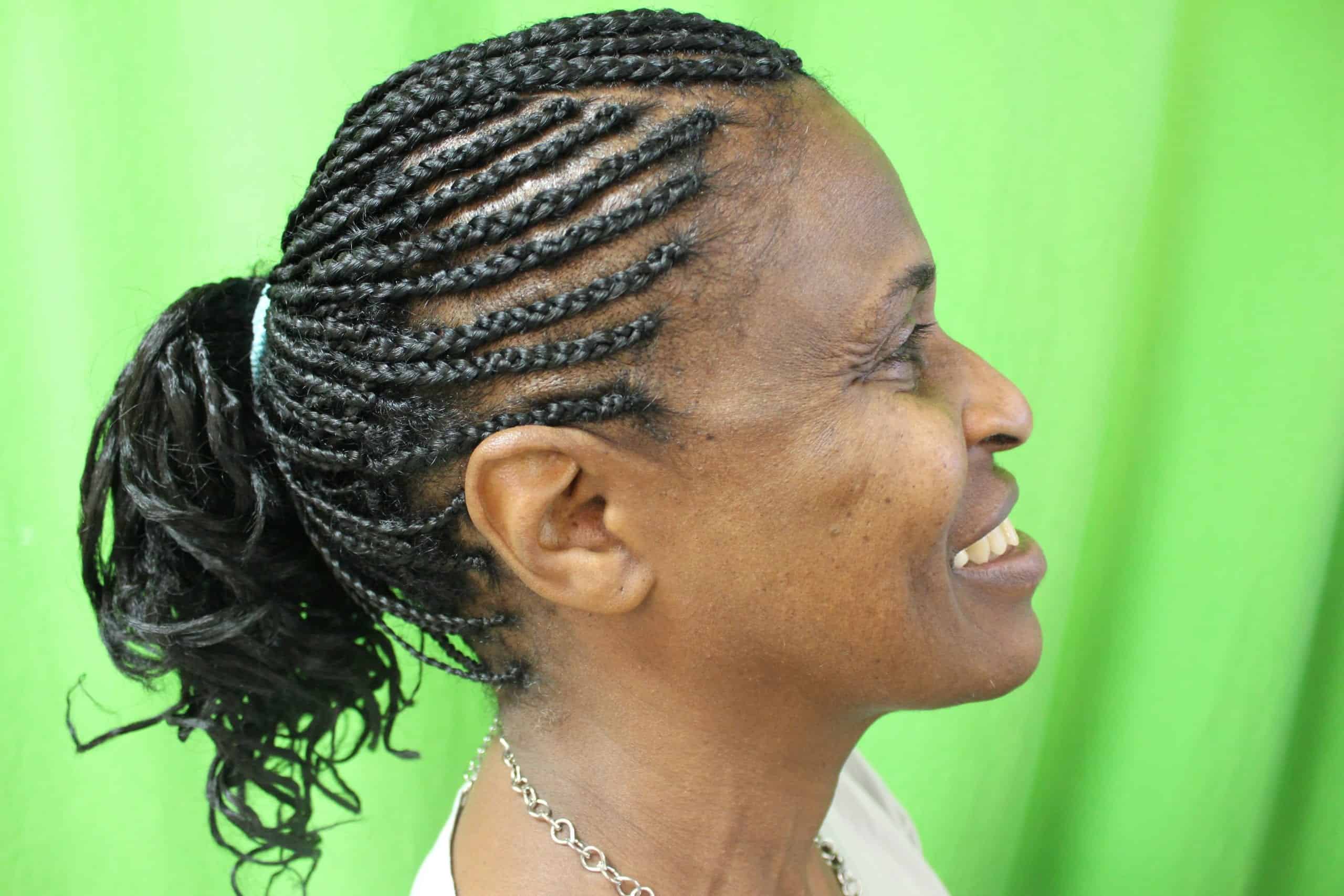 DPN removal healing shows remarkable clearer skin: dpn removal before and after DPN removal healing shows remarkable clearer skin: dpn removal before and after
