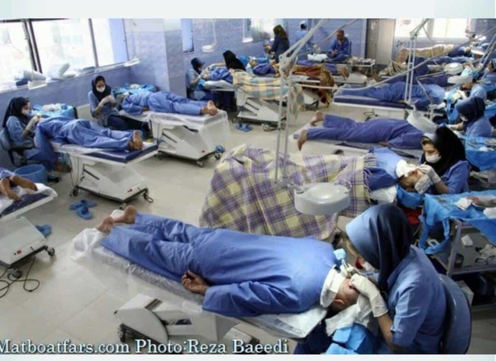 Perils of hair transplant tourism: Assembly line mass production approach using unlicensed staff to perform surgery explains cheap prices. Photo c/o baldingblog.com Perils of hair transplant tourism : An assembly hair transplant medical tourism clinic in iran. poor quality work results in poor quality result. You do get what you pay for