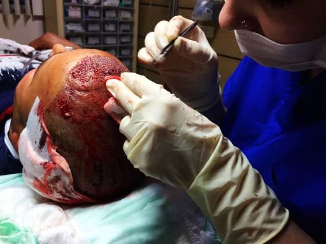 A nurse performing transplant in a clinic in abroad. Photo c/o https://qz.com/ A nurse performing transplant in a clinic in turkey