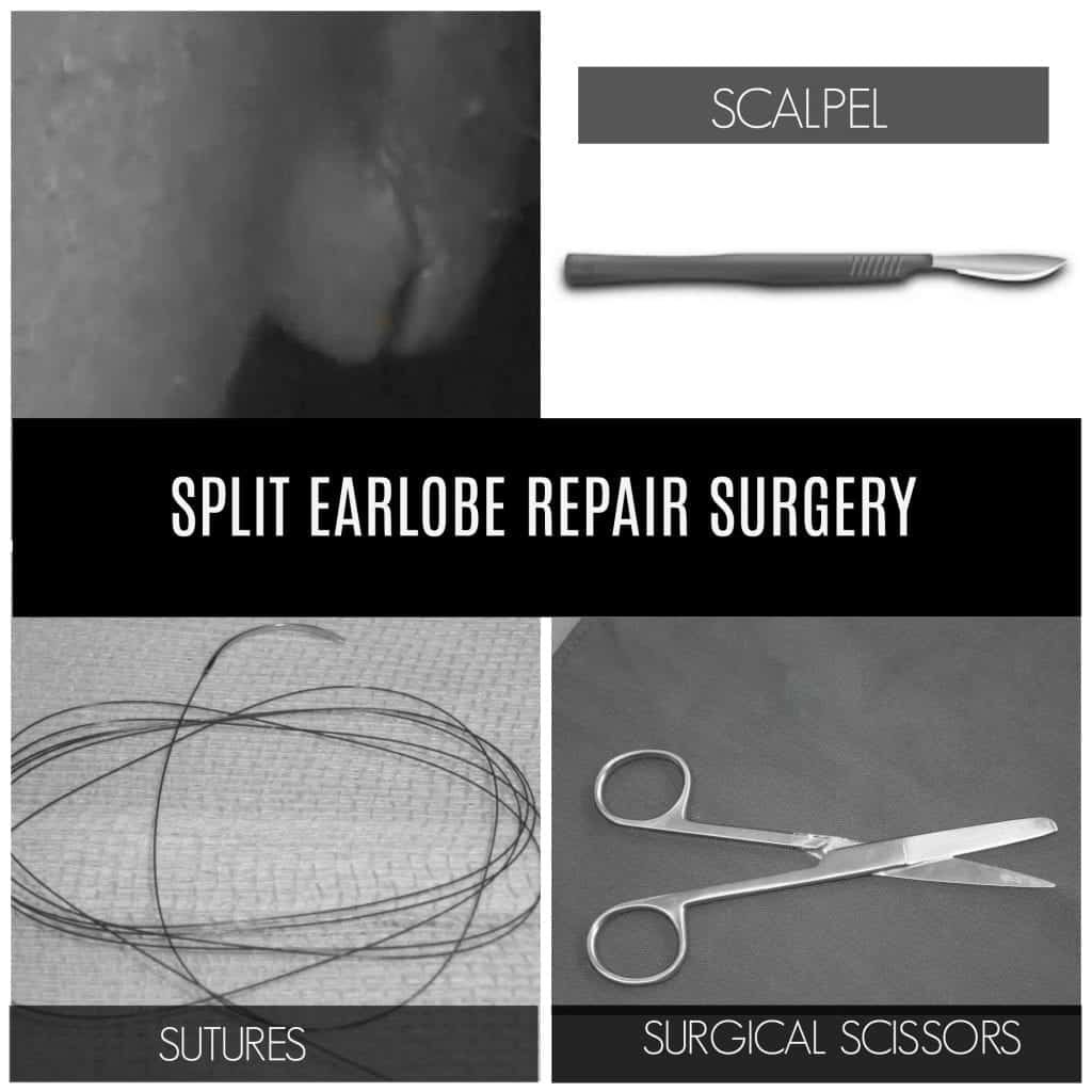 Pictured above is another patient example of a split earlobe prior to treatment, and the typical tools Dr. U uses in order to repair the earlobe. 